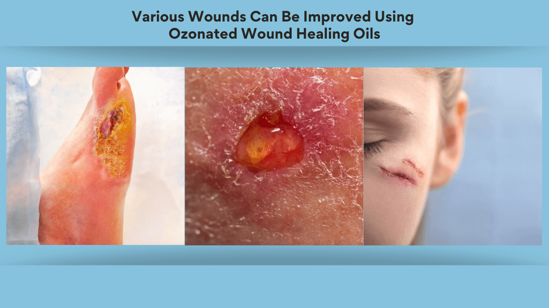 wound-healing-oil
